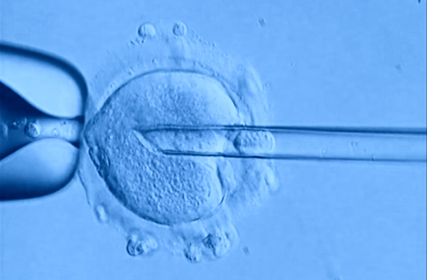 3DNA
